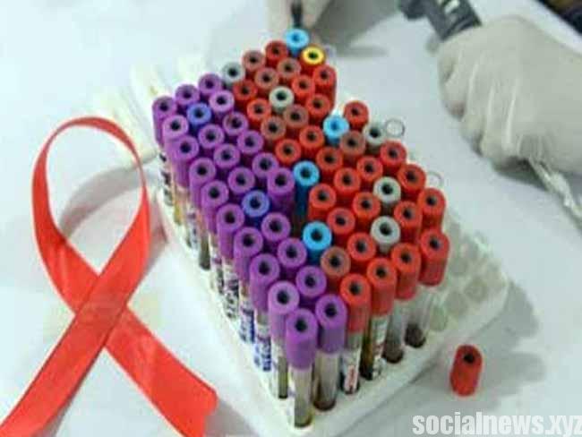 New Breakthrough May Lead to HIV Relapse Cure