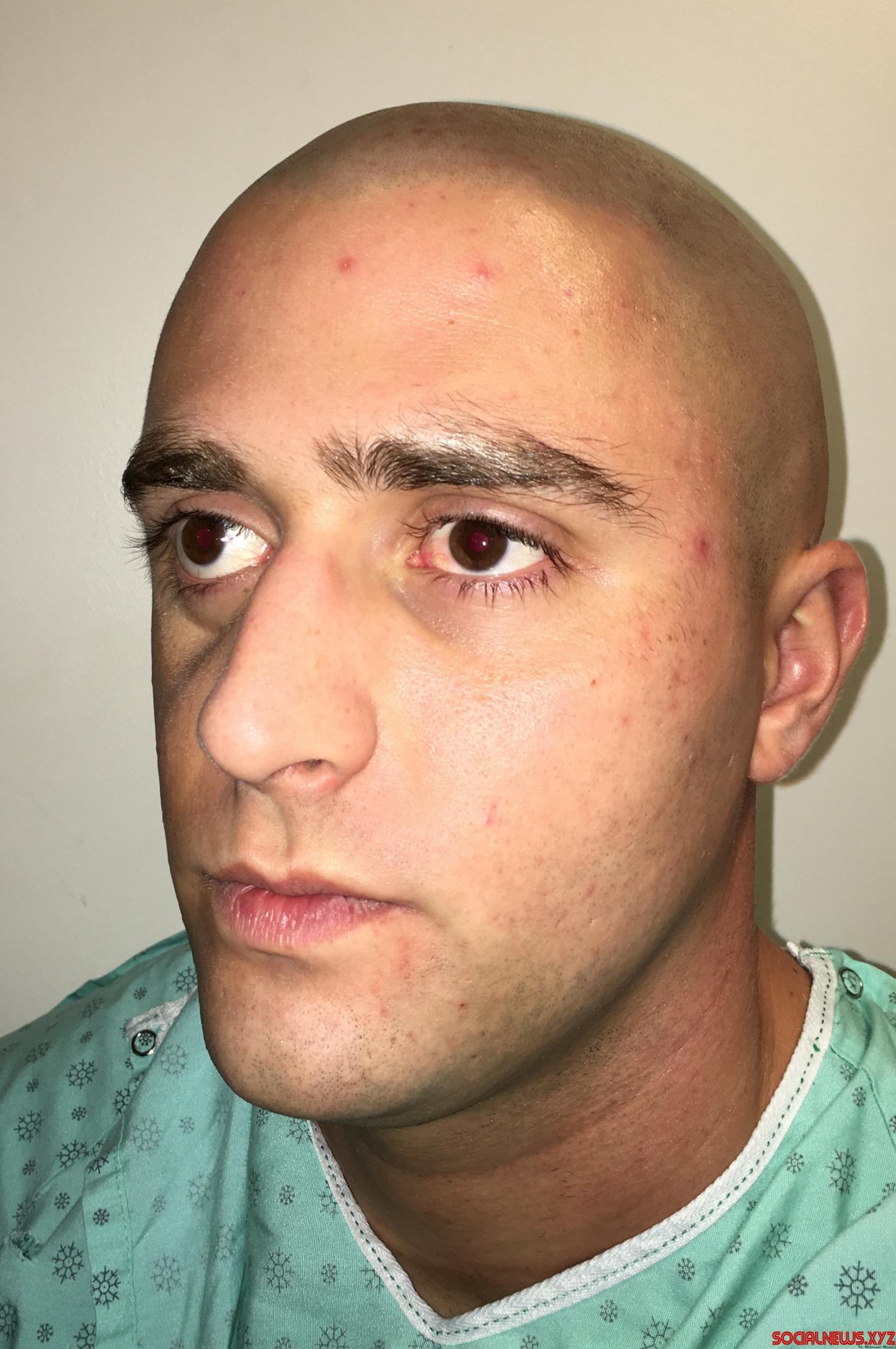 Canadian Doctors Make Scar-Free Plastic Surgery Possible