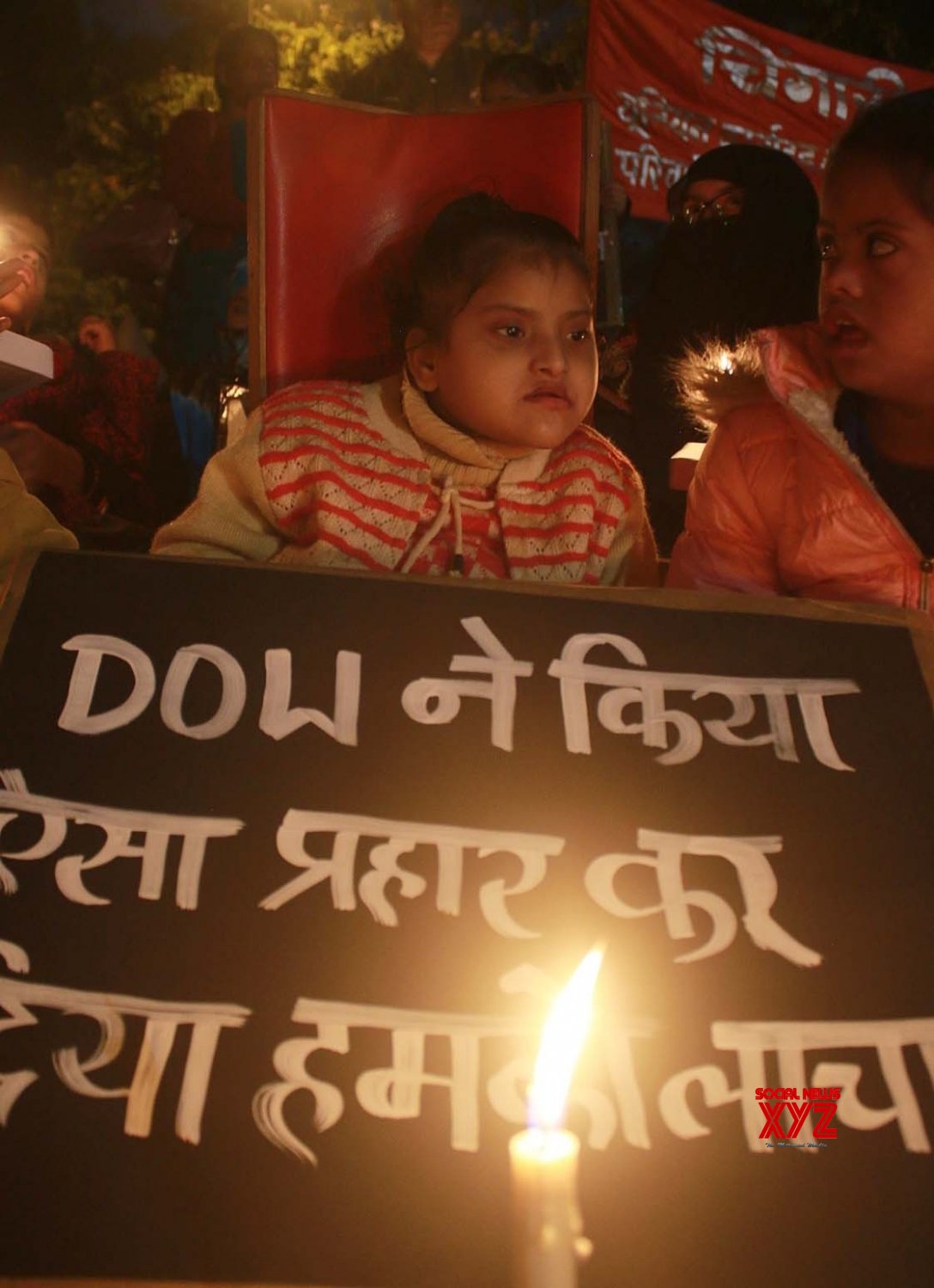 : Bhopal :Childrens Born With Congenital Diseases During A Candlelight ...